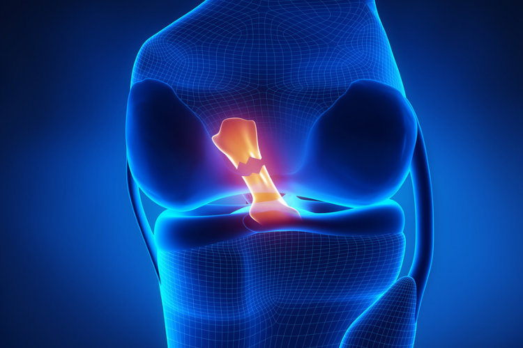 Alternative Pre & Post ACL Operation Care