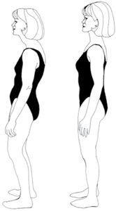 Posture Assessment Paul Oakfield | Health Space Clinics