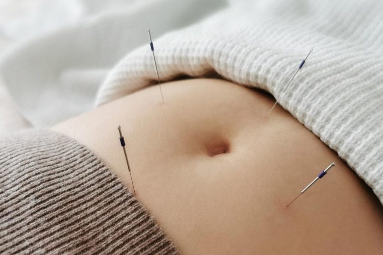 Acupuncture & pregnancy