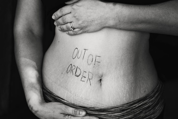 What You Need To Know About Leaky Gut