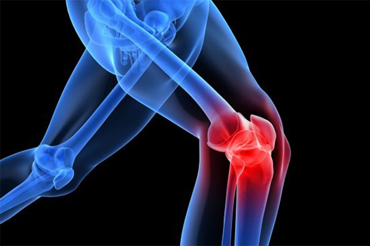 ACL Injury Symptoms And Treatments • Paul Miano, 42% OFF