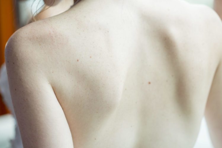 Massage and scoliosis by massage therapist Ella