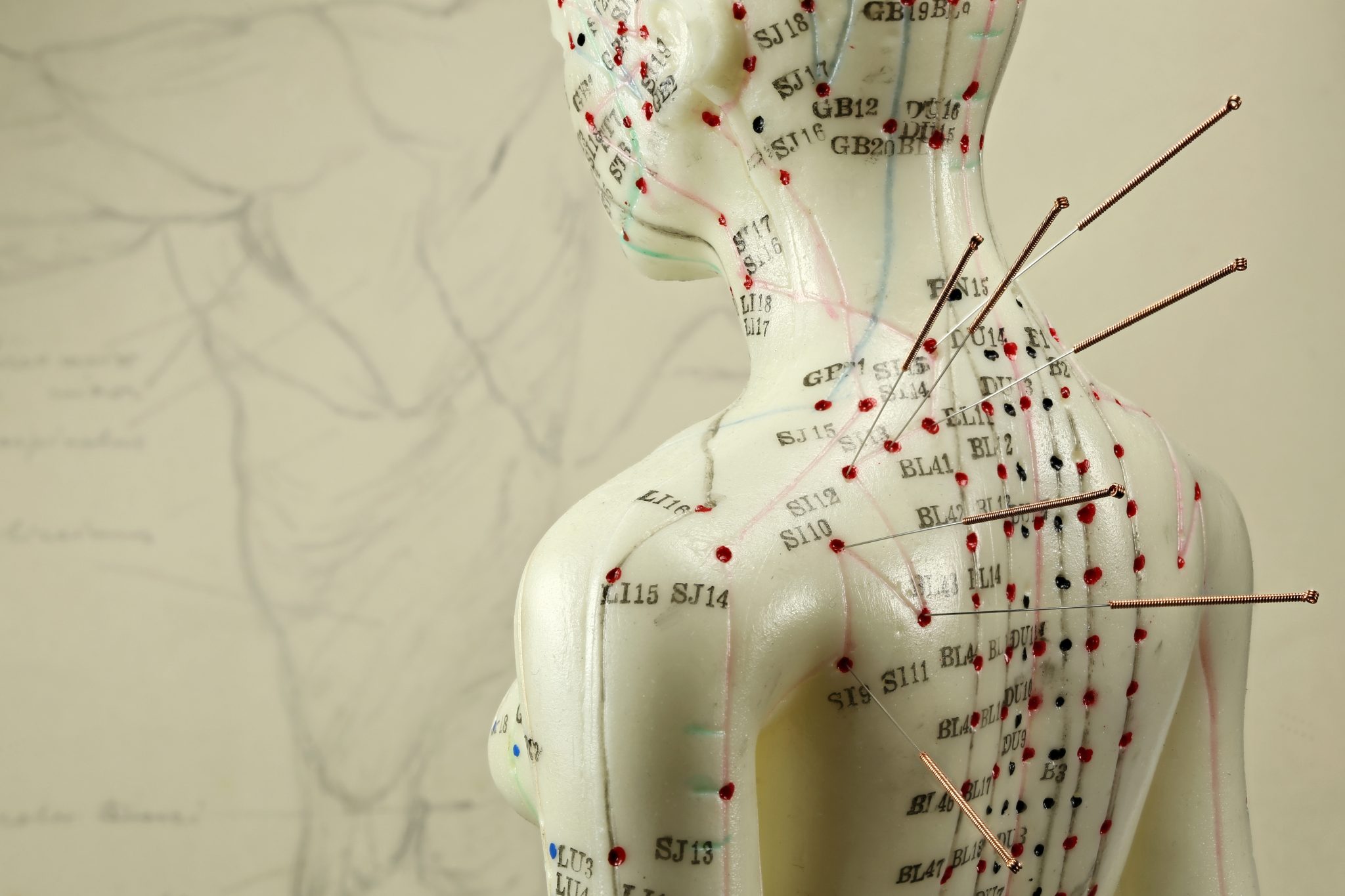 Acupuncture; Posture, Pain and Movement Health Space Clinics